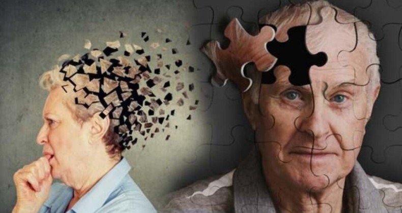 Demans ve Alzheimer Arasındaki Farklar Nelerdir?